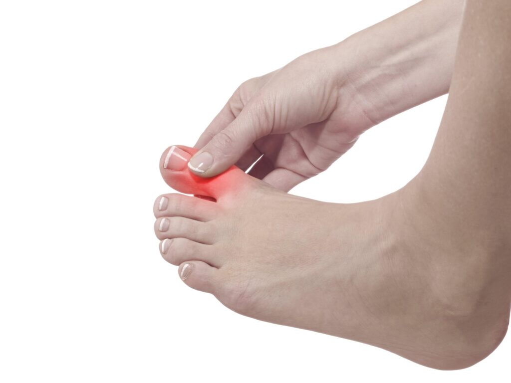 Person with gout pain